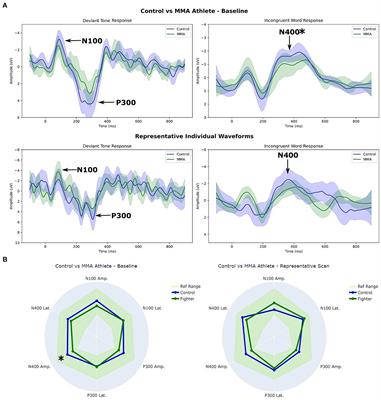 Mixed martial arts athletes demonstrate different brain vital sign profiles compared to matched controls at baseline